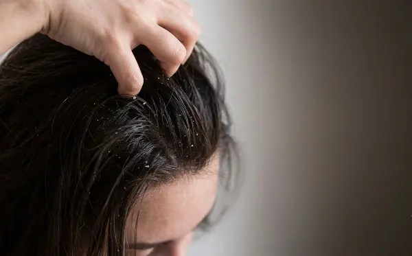 गर्मी में क्यों चिपचिपे हो जाते हैं बाल? जानें आसान हेयर केयर टिप्स