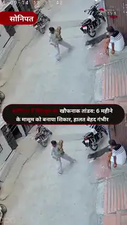 6 महीने के मासूम पर पिटबुल का हमला